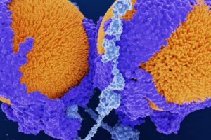 An Experimental Single-Time Treatment Slashed Cholesterol for a Year